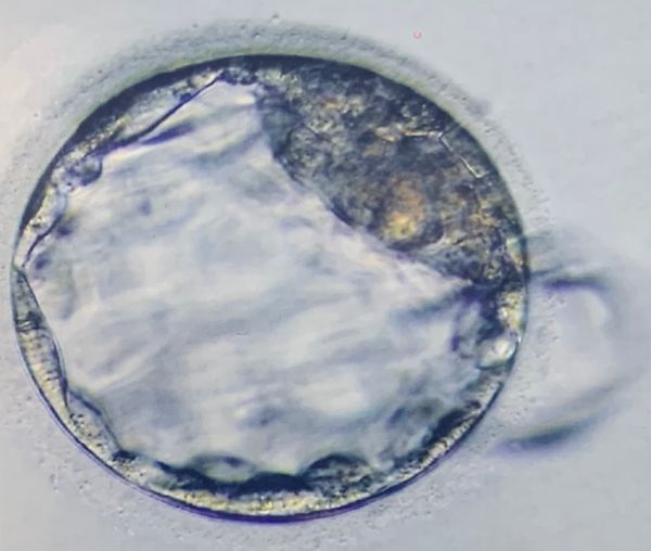 Watching early embryo development changed how we think about human life